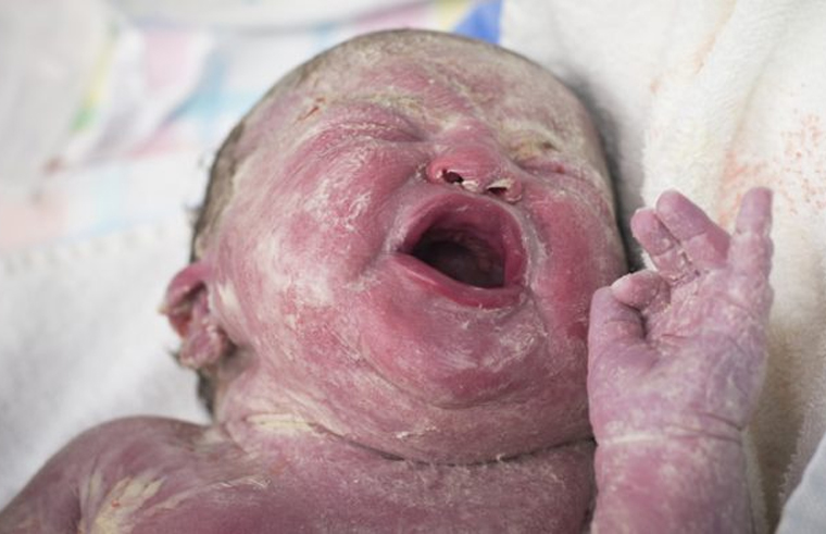 7 Reasons To Keep That Miracle Vernix Coating On Your Bub S Skin After Birth