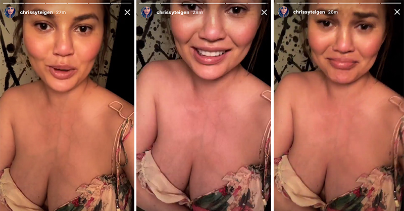 Breastfeeding mum Chrissy Teigen's freaking out about her veiny