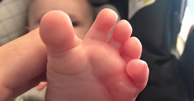 Mum S Warning After Popular Baby Monitor Burns Her Baby S Foot