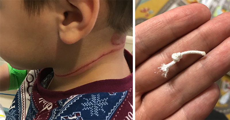 Mum's warning after her preschooler is strangled by blind cord