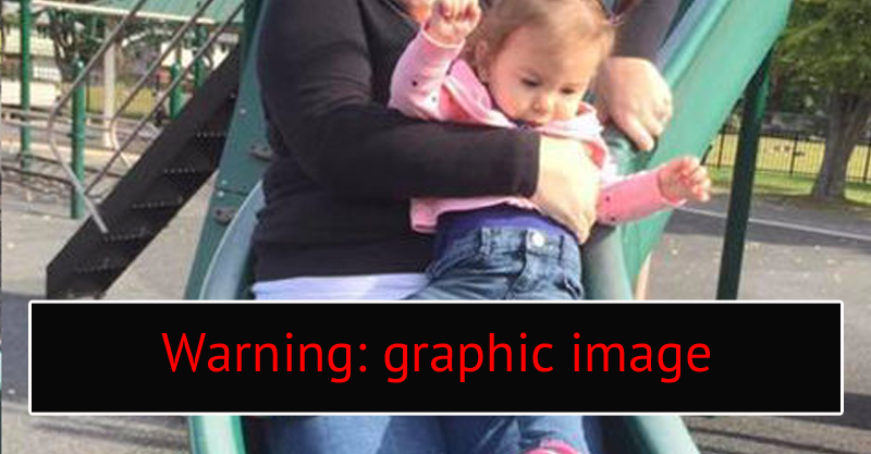 Eye-watering photo shows why adults shouldn't slide with kids on their lap